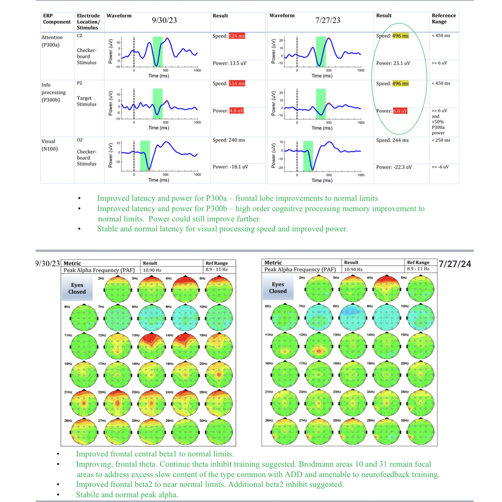 Featured image for “NeuroFeedback and Traumatic Brain Injury: My Journey by Dan Jarvis.”